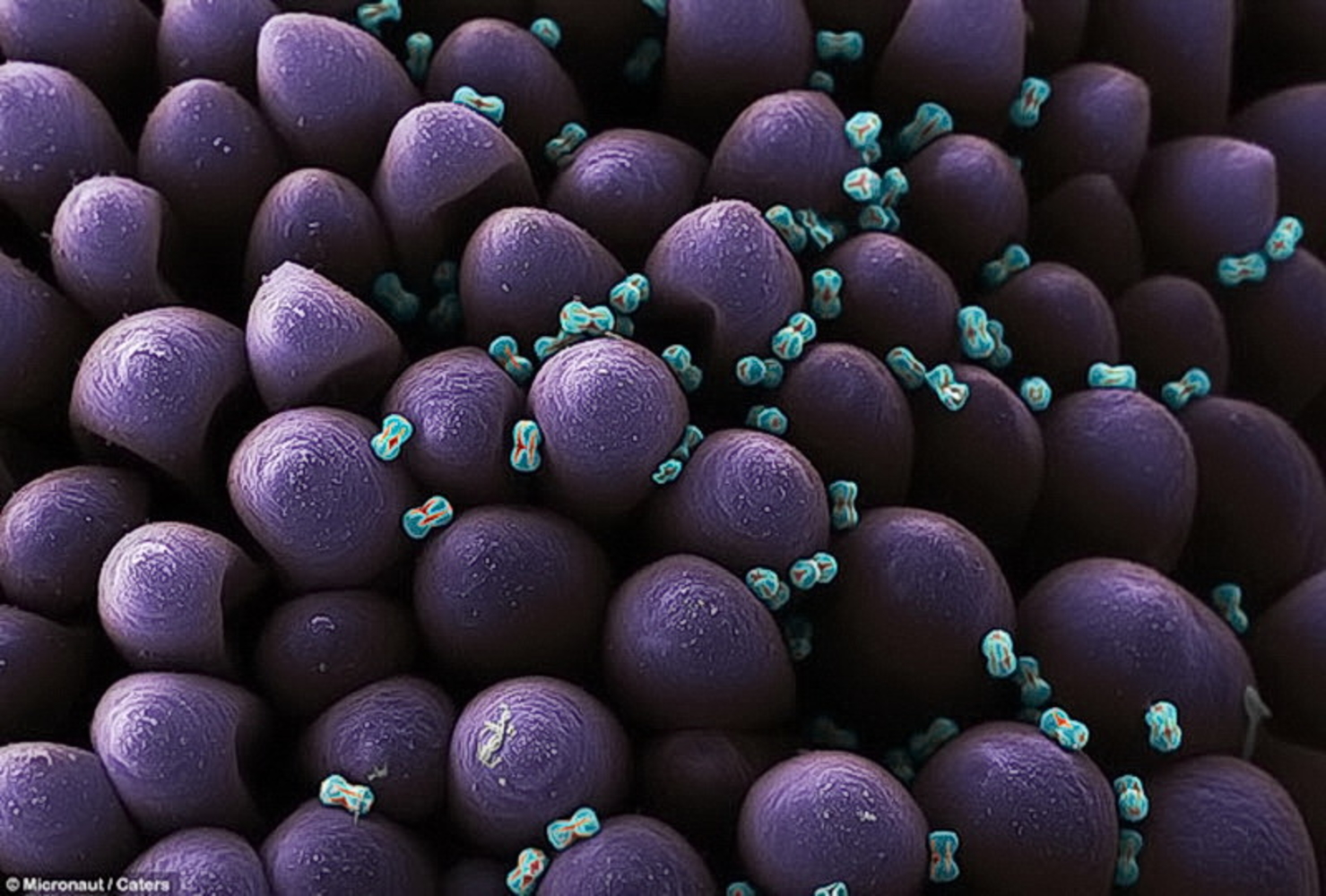 Гены пыльцы. Пыльца цветковых растений под микроскопом. Пыльца цветка под микроскопом. Пыльца тюльпана под микроскопом. Пыльца под электронным микроскопом.