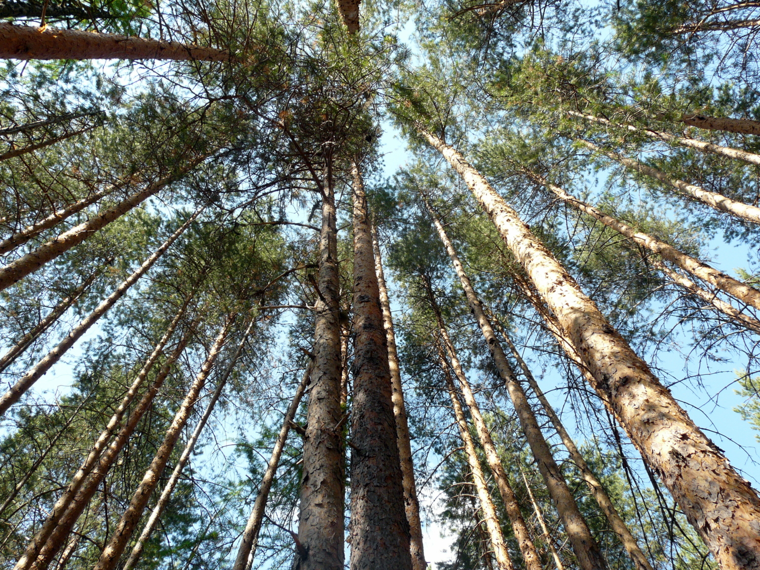 головокружение